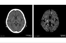 左がCT画像、右がMR画像 ※図1